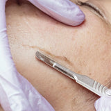Dermaplaning