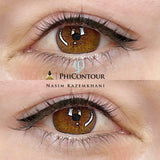 PHICONTOUR ONLINE