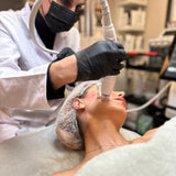 RF Microneedling – Radiofrekvens