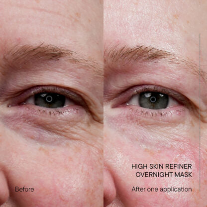 Lysbilde