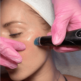 Kvinne får Hydrafacial behandling for glødende hud med dyprens og fukt i ansiktet.