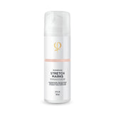 Microneedling Stretch Marks After Care Cream 150 ml