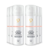 Microneedling Stretch Marks After Care Cream 150 ml