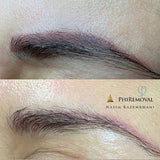 Fjerning av Permanent Makeup (PMU)