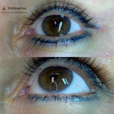 Fjerning av Permanent Makeup (PMU)
