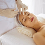PRP: Ansikt m/ microneedling - Sacha Hudpleie