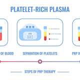 PRP: Ansikt og Hals m/ microneedling - Sacha Hudpleie