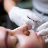 Restylane Leppe - Sacha Hudpleie